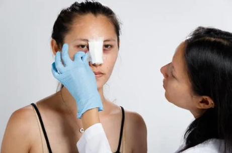 Best rhinoplasty surgeon Hollywood