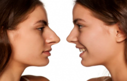 Rhinoplasty financing Hollywood